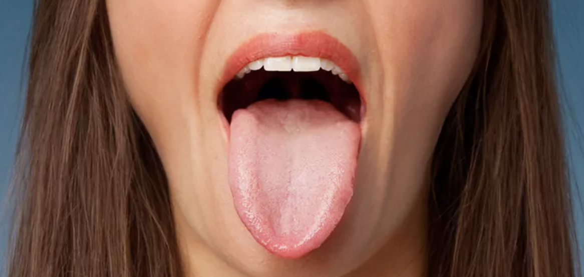 Lengua Mostrando Pequeñas Marcas
